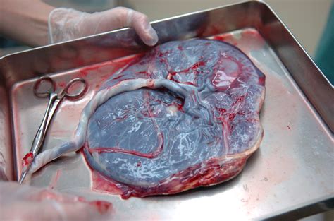 Infografía: la placenta como órgano de conexión y nutrición entre la madre y el embrión.
