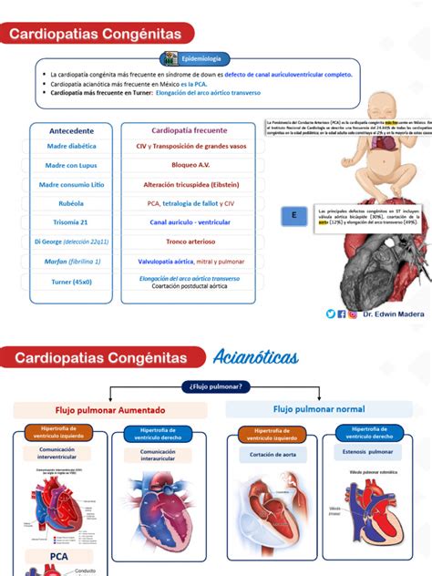 Tabla resumen de los tipos de shunts en cardiopatías congénitas