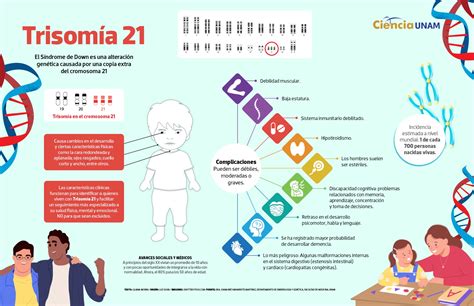 Infografía que muestra los cromosomas, destacando la trisomía del cromosoma 21 en el síndrome de Down.