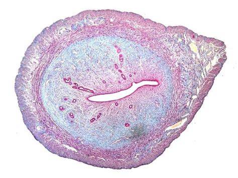 Corte transversal del útero de un tiburón vivíparo mostrando la pseudoplacenta