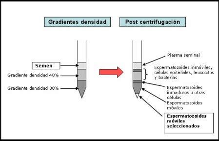 Infografía comparativa entre la técnica de gradientes de densidad y el método swim-up.