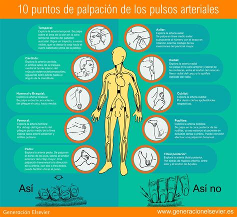 Esquema de los puntos de palpación de pulso en un bebé (radial, braquial, femoral, carotídeo)
