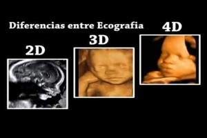 Comparativa visual de imágenes de ecografía 3D, 4D y 5D.