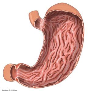 Ilustración de un estómago humano con énfasis en el revestimiento gástrico y el efecto protector del misoprostol.