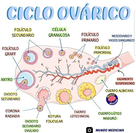Diagrama que ilustra la formación de un endometrioma ovárico y su invaginación en el tejido ovárico