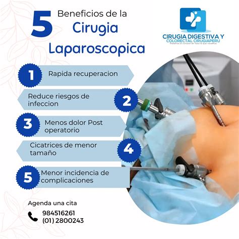Diagrama del procedimiento de laparoscopia, mostrando las incisiones y la introducción de instrumentos