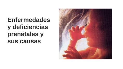 Infografía detallando las causas prenatales y perinatales de la policitemia neonatal