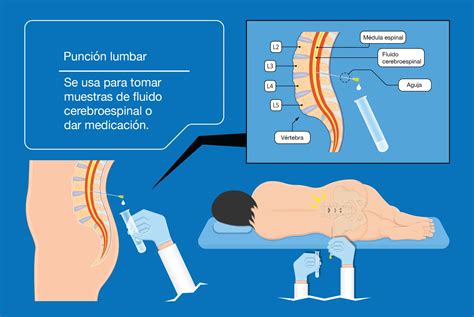 Diagrama de flujo para la punción lumbar en pediatría, detallando pasos y precauciones.