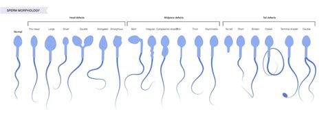 Esquema comparativo de la morfología espermática entre diferentes especies de mamíferos