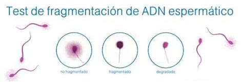 Ilustración comparativa de espermatozoides con ADN intacto y ADN fragmentado.