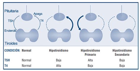 Gráfico comparativo de los niveles de T3 y T4 en embarazo normal, hipotiroidismo e hipertiroidismo