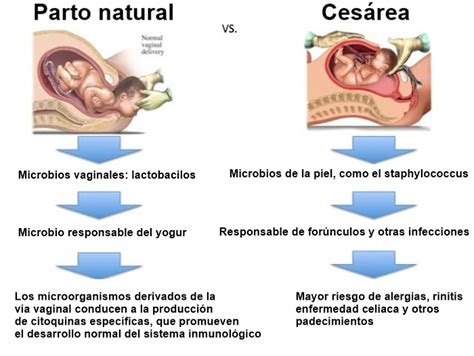 Esquema comparativo entre el parto vaginal y la cesárea: procesos, tiempos de recuperación y consideraciones médicas.