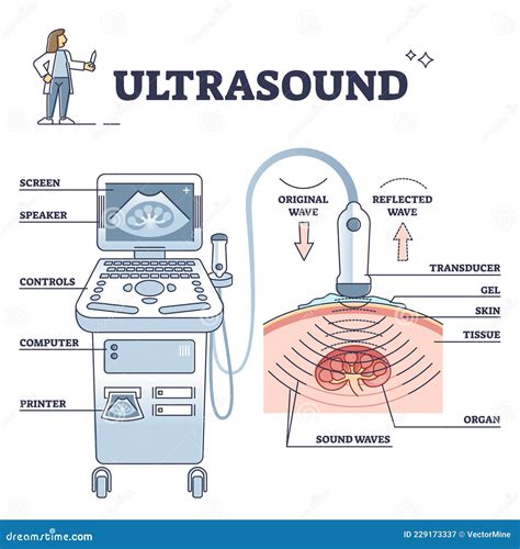 Esquema explicativo del funcionamiento de un ecógrafo: emisión de ultrasonidos por un transductor, reflexión en tejidos y creación de la imagen en pantalla.
