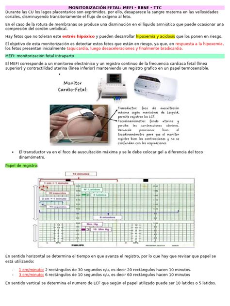 Esquema de monitorización fetal externa con bandas abdominales