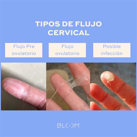 Infografía comparativa de flujo cervical, secreción vaginal y lubricación sexual