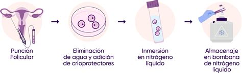Esquema ilustrativo del proceso de criopreservación de corteza ovárica: desde la biopsia laparoscópica hasta el almacenamiento en nitrógeno líquido y el posterior reimplante.