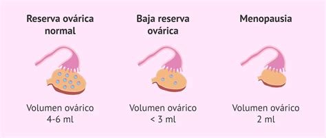 Esquema ilustrativo del proceso de reserva ovárica, mostrando el pool inicial de ovocitos y su disminución gradual a lo largo de la vida reproductiva.