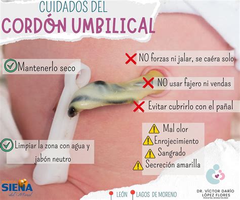 Esquema visual mostrando las etapas de secado del muñón umbilical desde el nacimiento hasta su caída natural.