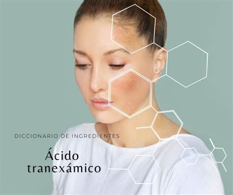 Infografía: cómo actúa el ácido tranexámico en la piel para reducir la hiperpigmentación.