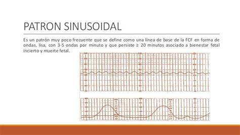 Ejemplo de trazado de FCF con patrón sinusoidal