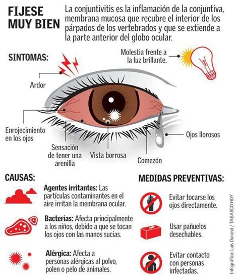 Infografía sobre medidas preventivas de la conjuntivitis neonatal