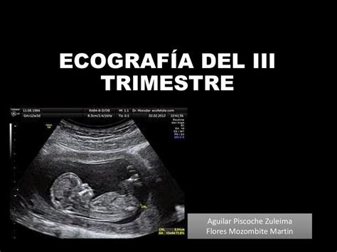 Ecografía fetal de tercer trimestre