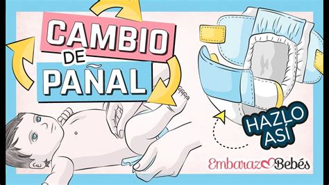 Diagrama de colocación de un pañal en un recién nacido, mostrando el ajuste del ombligo
