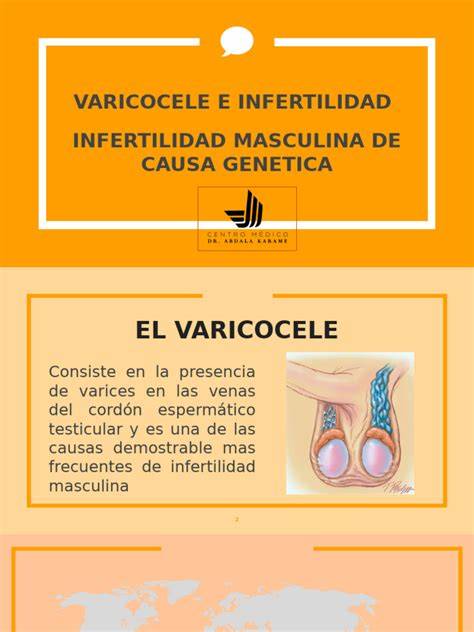Ilustración: Varicocele y su impacto en la temperatura testicular