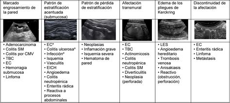 Gráfico comparativo de las características ecográficas clave para el diagnóstico diferencial entre GEC y embarazo en cicatriz de cesárea