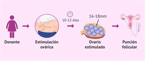 Esquema del proceso de ovodonación desde la estimulación ovárica hasta la transferencia embrionaria