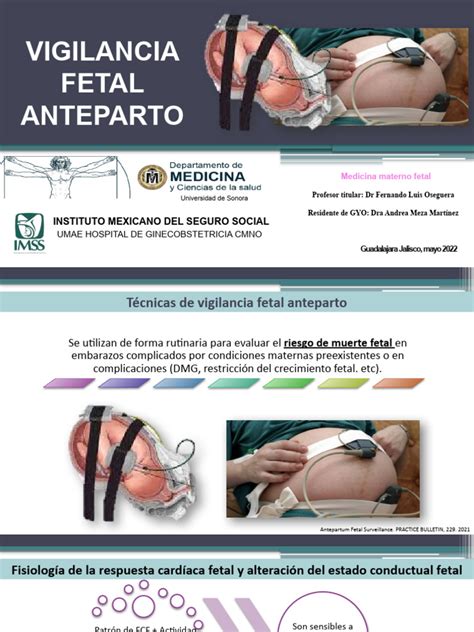 Diagrama de flujo de vigilancia fetal con pulsioximetría