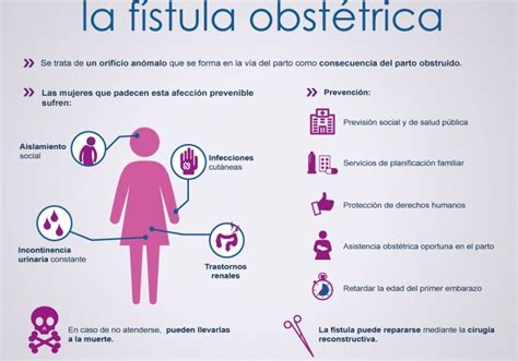 Infografía sobre los pilares de prevención de la fístula obstétrica