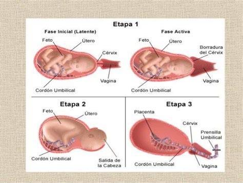 Esquema de las fases del parto