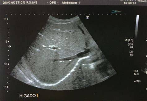 Ecografía abdominal mostrando una masa en el área ovárica de una perra