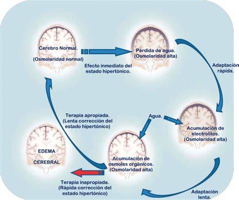 Esquema de las causas de deshidratación hipernatrémica en neonatos (pérdida de agua excesiva, ingesta inadecuada, sobrecarga de solutos)