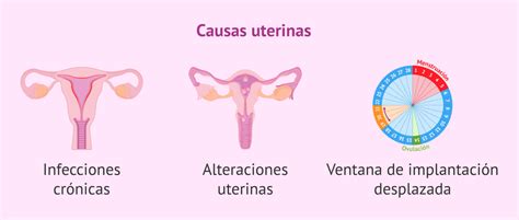Representación gráfica de las diferentes causas de fallo de implantación: embrionarias, uterinas y sistémicas.