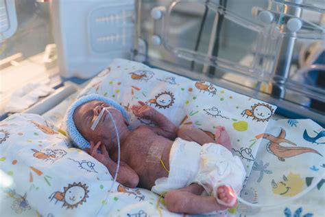 Foto temática de un recién nacido prematuro siendo asistido con CPAP nasal en una incubadora