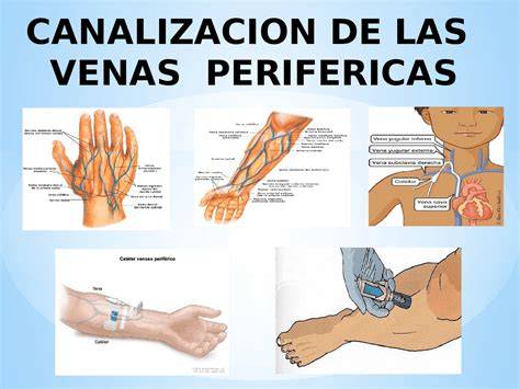 Esquema de las principales venas centrales utilizadas para la inserción de catéteres venosos en pediatría.