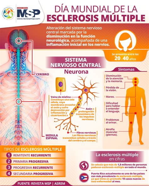 Infografía sobre la esclerosis múltiple y su compatibilidad con el embarazo.