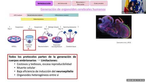 Diagrama de la generación de organoides a partir de células madre amnióticas