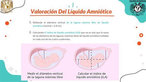 Infografía comparativa que detalla los métodos de medición ILA y MPV para el diagnóstico de niveles de líquido amniótico.