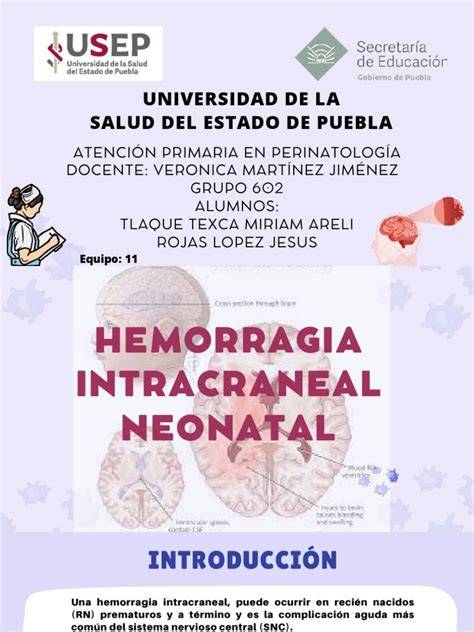 Diagrama de las diferentes áreas de hemorragia intracraneal en neonatos