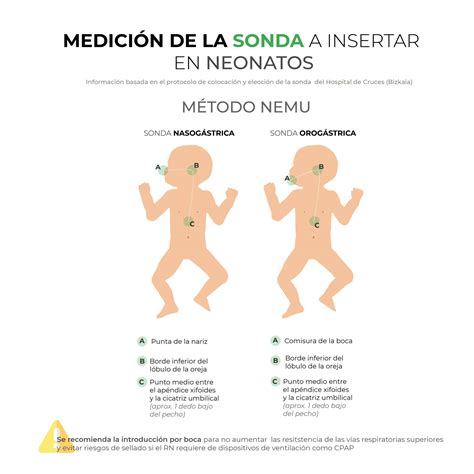 Ilustración del método NEX para medir la longitud de la sonda orogástrica/nasogástrica en un neonato, con advertencia sobre su uso limitado