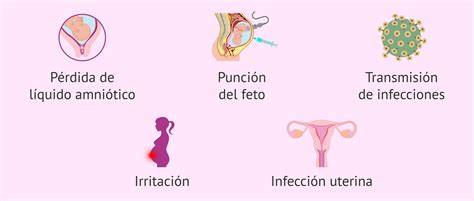 Representación visual de los posibles riesgos de la amniocentesis