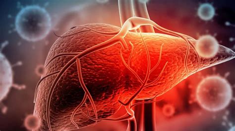 Esquema de las clasificaciones temporales de la hepatitis fulminante en lactantes