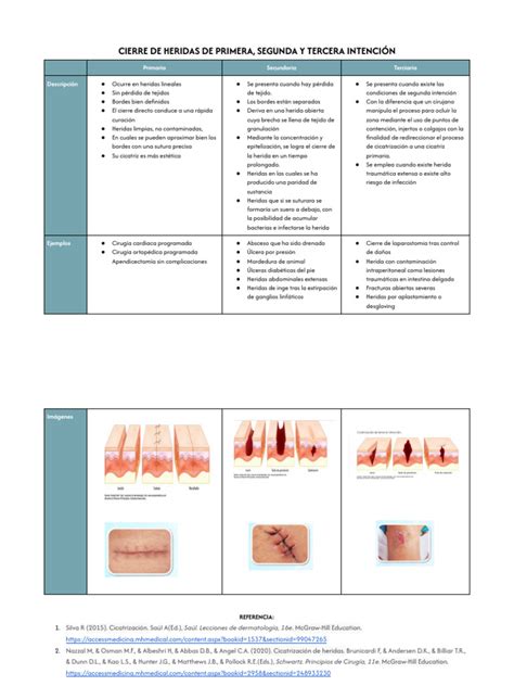 Diagrama de los diferentes métodos de cierre de heridas post-cesárea: sutura, grapas y adhesivo