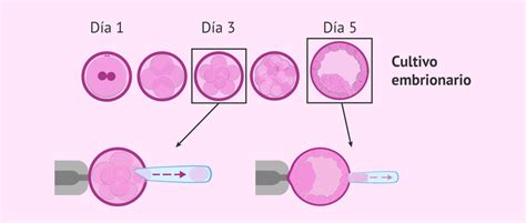 Diagrama comparativo de biopsia embrionaria en día 3 y día 5