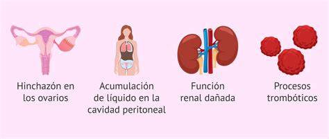 Diagrama de los síntomas y las consecuencias del Síndrome de Hiperestimulación Ovárica (SHO)