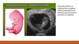 Esquema de medición de la Longitud Cráneo-Caudal (CRL) en un embrión