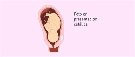 Imagen de ecografía que muestra la presentación cefálica del feto